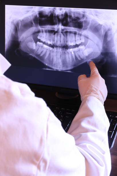 Best Knocked-Out Tooth (Avulsed Tooth) Treatment in Sandstone, MN
